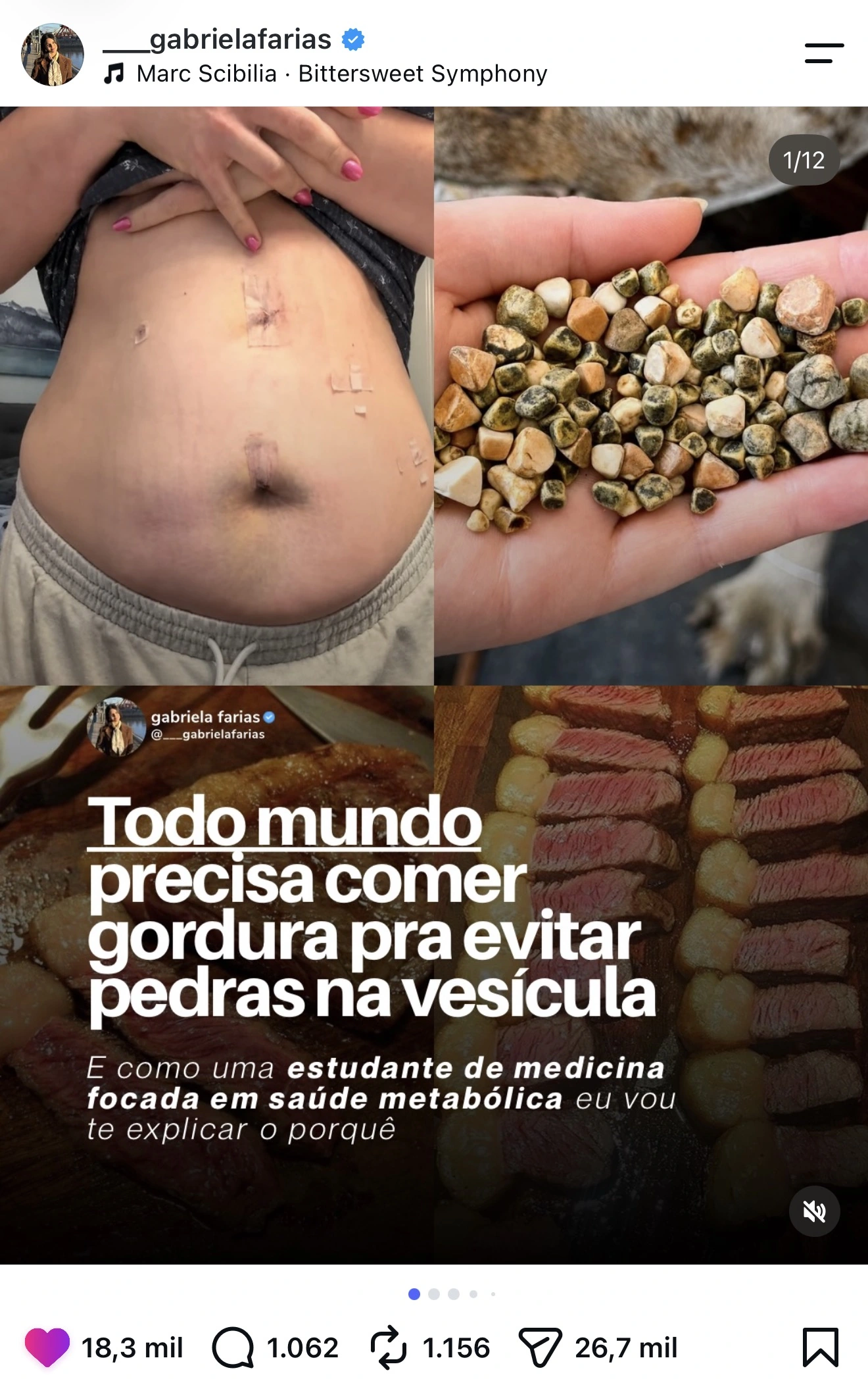 Post da Gabriela Farias com 18,3 mil curtidas: Todo mundo precisa comer gordura pra evitar pedras na vesícula